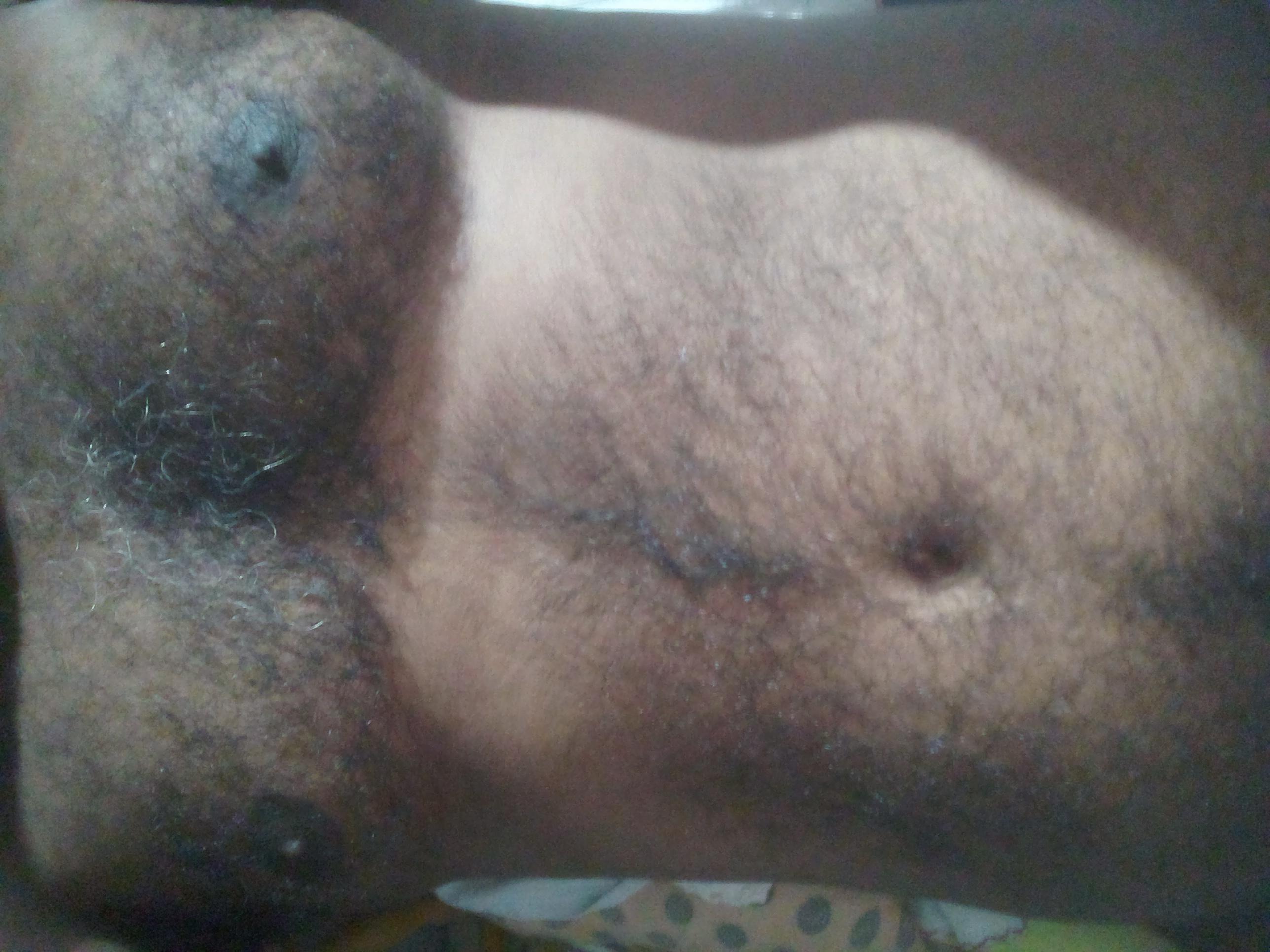 Image of Therapy